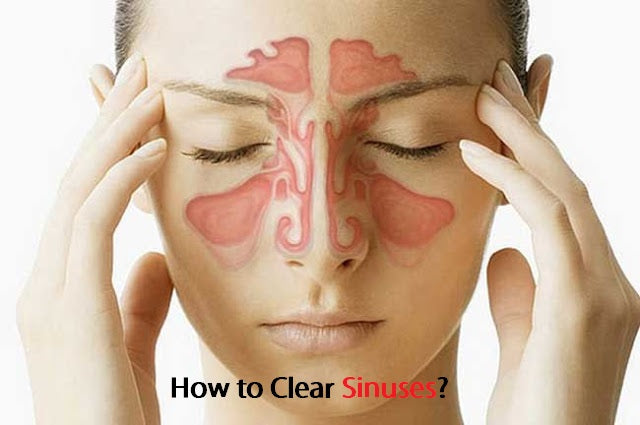 Sinus Relief Blend 5ML